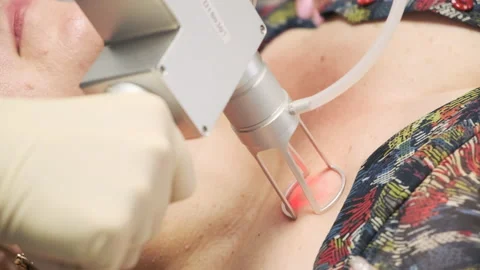 Close-up. The doctor performs a procedure for lifting with a laser Stock Footage 144987677