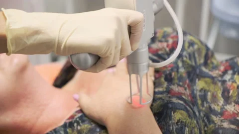 Close-up. The doctor performs a procedure for lifting with a laser Stock Footage 144991043