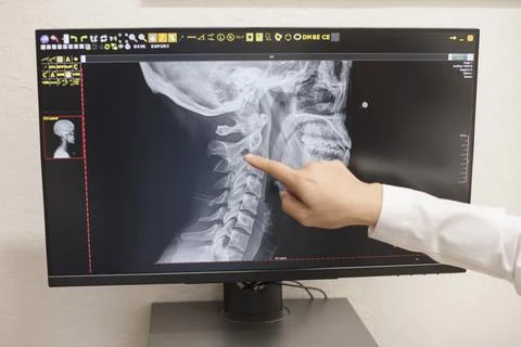 Close up of doctor pointing at x-ray on computer 库存照片