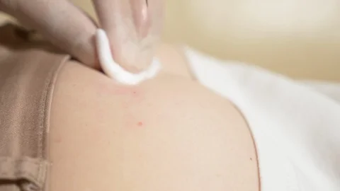 Close-up, the doctor puts an injection into the buttock of the patient. Stock Footage 114540458