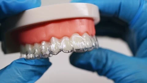 Close-up. The doctor puts transparent aligners on the teeth of the artifici.. Stock Footage 304363894
