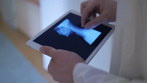 Close-up of doctor studying an x-ray image Stock Footage 75131555
