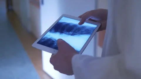 Close-up of doctor studying an x-ray image Stock Footage 75131594