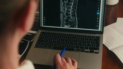 Close-up of a doctor viewing spinal MRI results on a laptop screen. Concept of Stock Footage 335277735