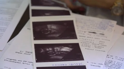 Close up of doctor's hands going through a pregnant woman's with twins exams  Stock Footage 113348051
