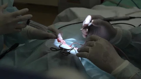 Close-up of doctors hands performing complex operation. Action. Professional Video stock 146210950