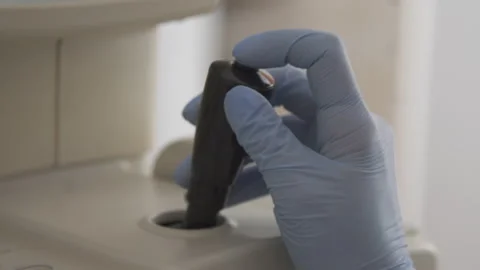 Close-up of the doctor's hands in rubber gloves, adjusting the equipment. Stock Footage 153285447