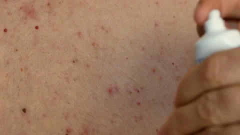 Close-up of doctors hands squeeze out medicine cream from a tube Stock Footage 119194998