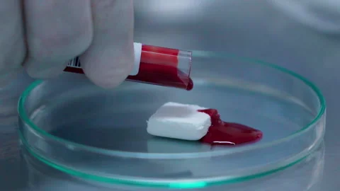 Close up Dropping blood to white sponge material in Lab Video stock 156167958