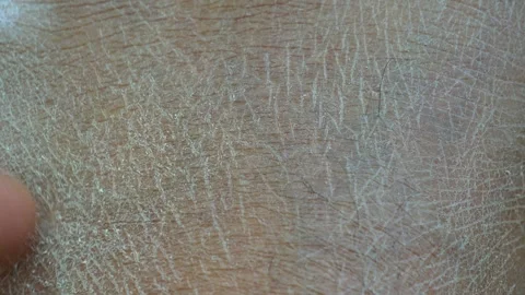 Close up of dry cracked skin texture with a finger gently touching surface. Stock-Footage 332745083
