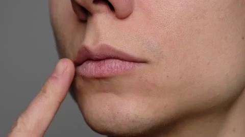 Close up of dry lips of an young man. Guy touching his dry lips with a finger, h Stock-Footage 296883847