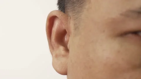 Close-up of ear, Asian man with hearing problems, congenital deafness Stock Footage 229276857