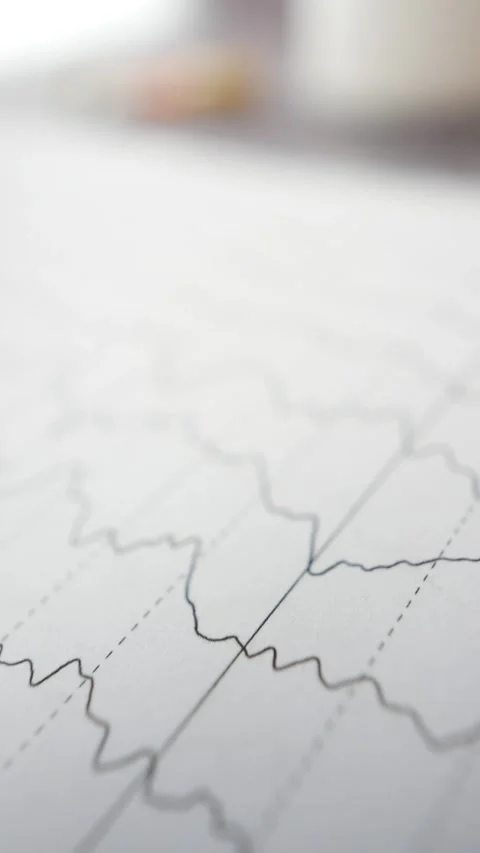 Close-up of a EEG graph Stock Footage 317527368