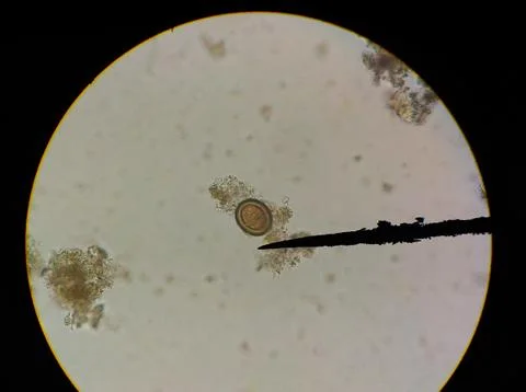 Close up egg with adult of parasite. Stock Photos
