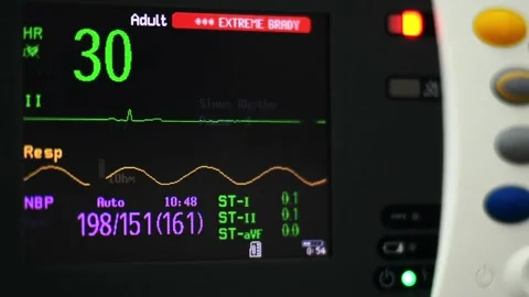 close-up ekg heart monitor flatline hosp... | Stock Video | Pond5