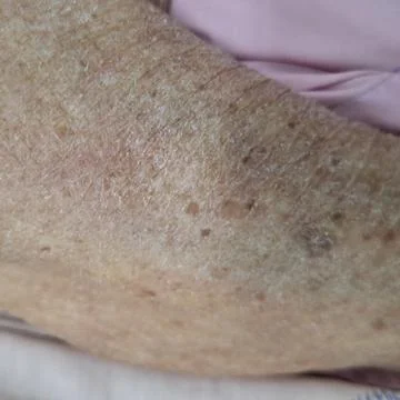 Close-Up of Elderly Skin with Dry Texture Stock Photos