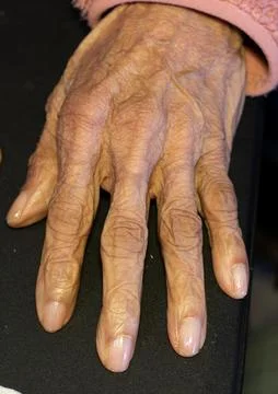 Close-Up of an Elderly Womans Hand Showing the Signs of Aging Stock Photos