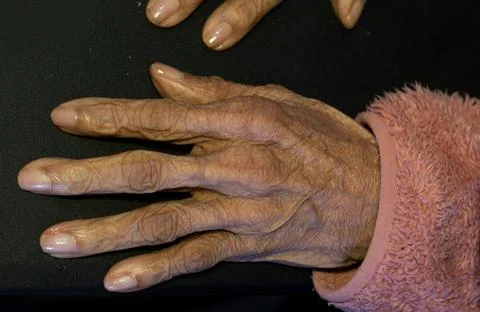 Close-Up of an Elderly Womans Hand Showing the Signs of Aging Stock Photos