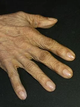 Close-Up of an Elderly Womans Hand Showing the Signs of Aging Stock Photos