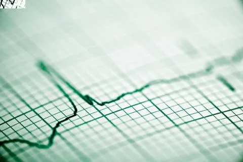 Close up of an electrocardiogram in paper form Stock Photos
