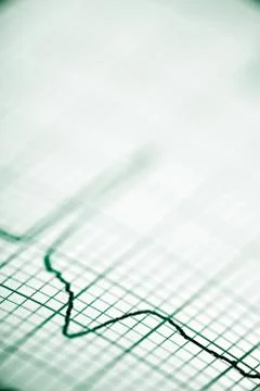 Close up of an electrocardiogram in paper form. Stock Photos