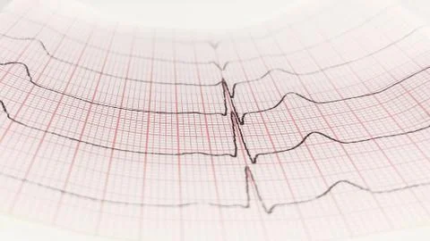 Close up of an electrocardiogram in paper form Stock Photos