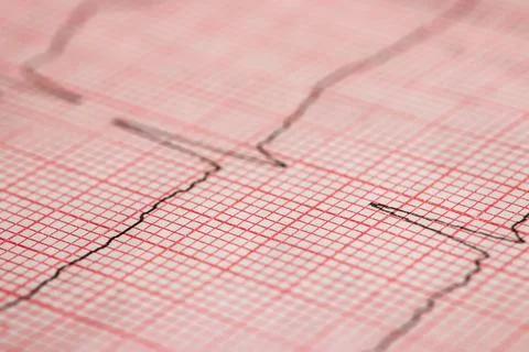 Close up of an electrocardiogram in paper form. 스톡 사진