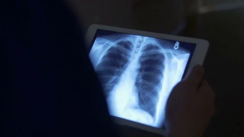 Close-up of evaluating an x-ray 動画素材 75132204
