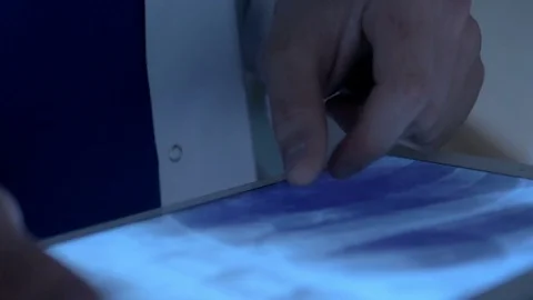 Close-up of evaluating an x-ray Stock Footage 75136007