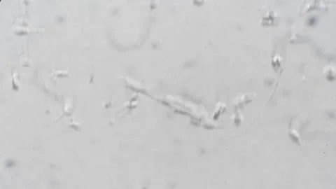 Close examination of human sperm flagella and heads using phase contrast Stock Footage 343951178