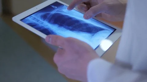 Close-up of examining x-ray images Stock Footage 75131464