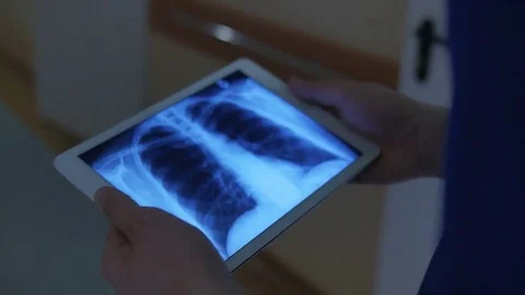 Close-up of examining the x-ray images Stock Footage 75131793