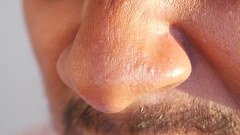 Close up extreme macro shot of human nose with visible pores and skin texture Stock Footage 332579773