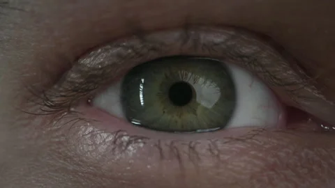 Close-up of an eye opening 스톡 동영상 307711346