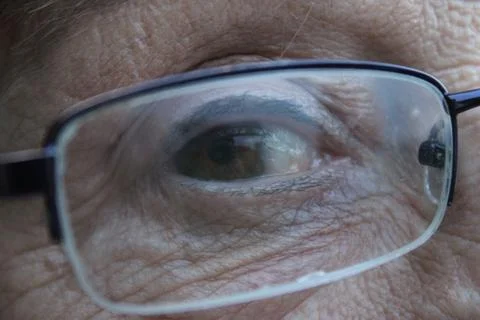 Close Up of an Eye Stock Photos