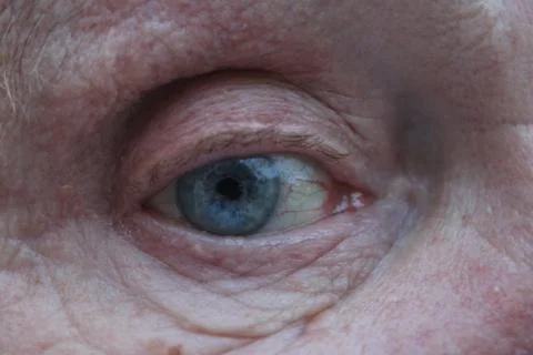 Close up of an Eye Stock Photos