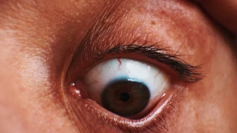 Close up of an eye on stretcher. Terrified man hospitalized Stock Footage 169347599