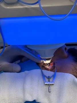 Close-up of eye surgery under blue light with surgical clamp Stockfoto's