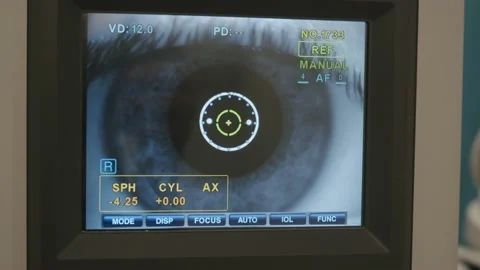 Close-up of an eye on TV at a doctor's appointment Stock Footage 140361305