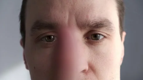 Close up eyes of a man. Eye exercises gymnastics for vision look Stock Footage 301959360
