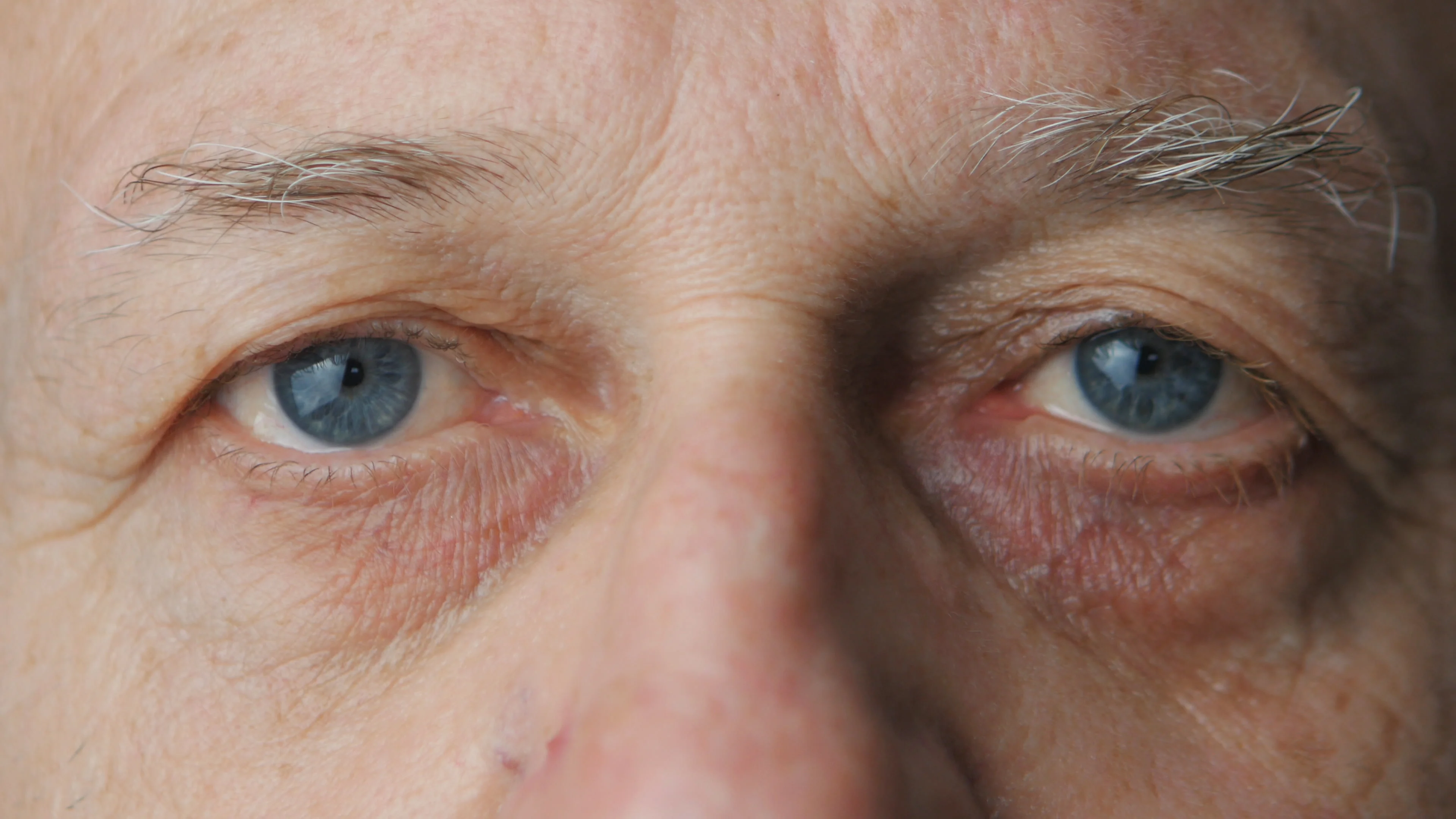 Если плакать глаза выцветут. Глаза пожилого человека. Заболевания глаз в пожилом возрасте.
