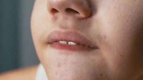 Close-up of the Face of a Nervous Child Biting his Lips with his Teeth. Macro Stock-Footage 179052253