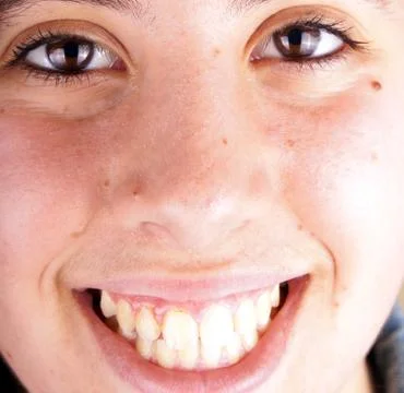Close up of the face of a young lady Stock Photos