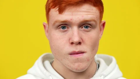 Close-up face of young redhead man with problematic skin posing at yellow Stock Footage 148246962