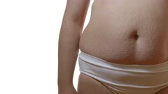 The Woman in Underwear Holds Belly Fat. Closeup., Stock Footage