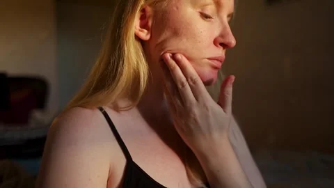 Close up of female face skin with post acne scars, enlarged pores, and rosacea. Stock-Footage 345050682