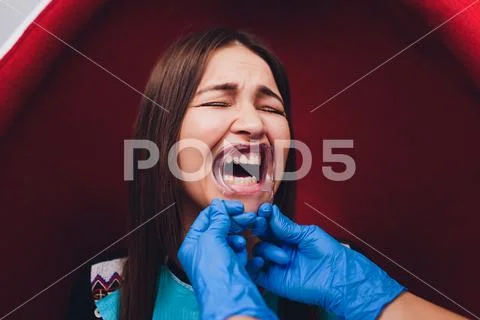 Close up of female mouth with retractor. Doctor flossing the teeth. Dental Gag. Stock Photos