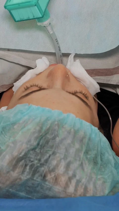 Close-up. female patient, in a state of anesthesia, lies on the operating table Video stock 317936629