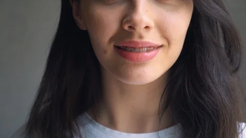 Close up Female Teeth with Braces and Interdental brush for Dental Braces Stock Footage 89924915