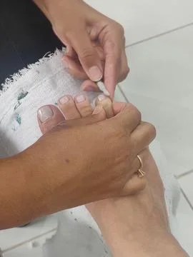 Close-up on a foot, with the completion of a manic Stock Photos